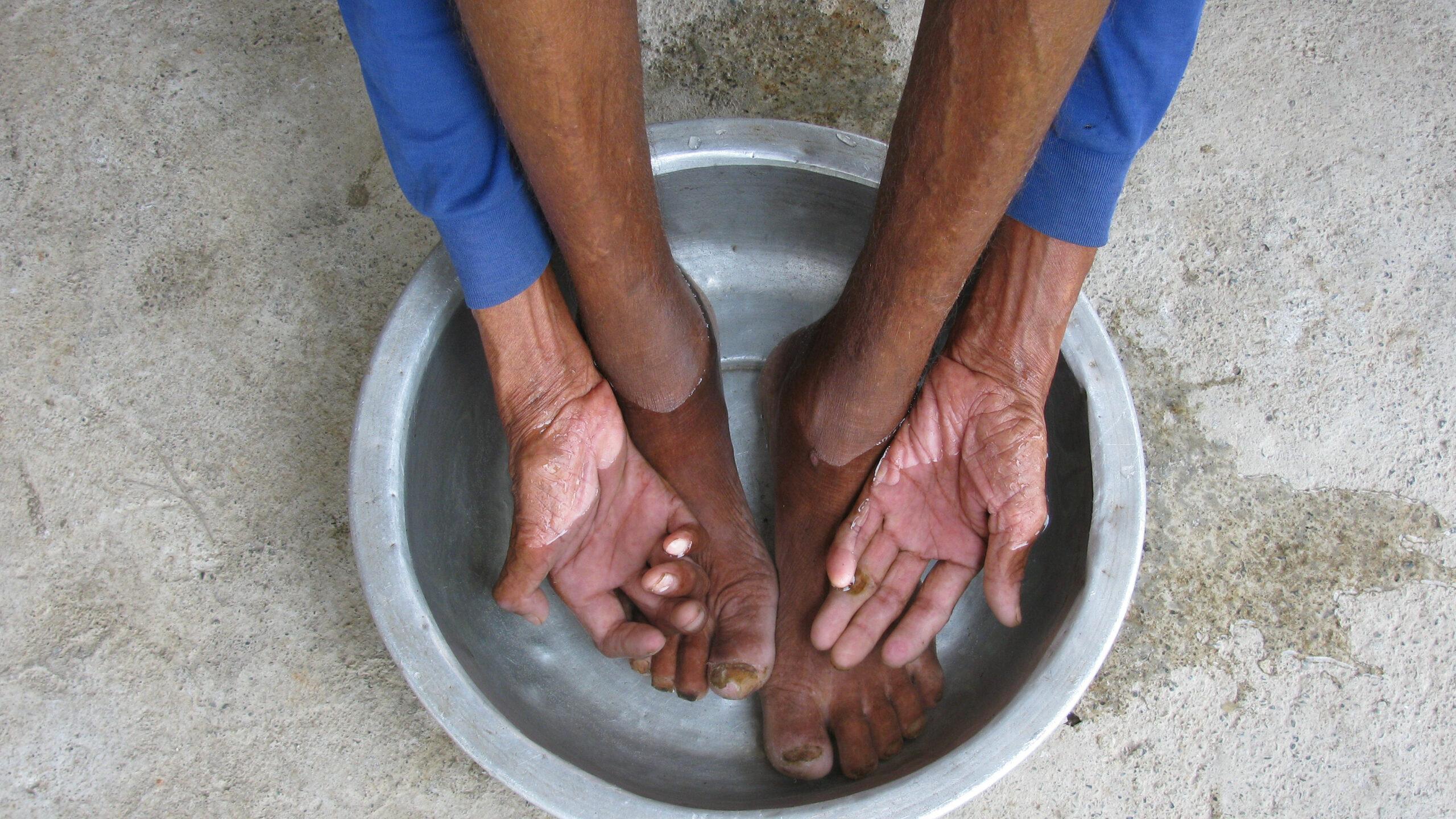 Lebra Hilfe Spenden Wash